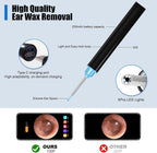 Smart Visual Ear Cleaner