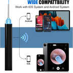 Smart Visual Ear Cleaner