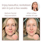 Get Parcel™ Facial Rejuvenation Device , Beauty Facial Massager,Wavy Chic Beauty Microcurrent Facial Device Hot Selling Product